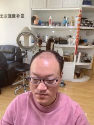 -靓康增发补发假发