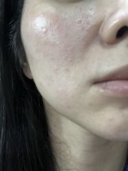 体验后-深圳美莱医疗美容医院