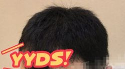 -大麦微针植发丨全国连锁