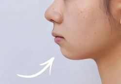 -天津健丽·去眼袋医疗美容机构