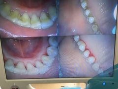 -赫尔森口腔·牙齿种植修复