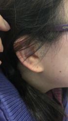 -肥三针腧穴瘦身馆