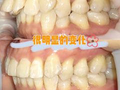 -爱雅仕口腔·数字化矫正中心(国贸门诊)