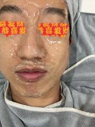 体验前-北京英煌医疗美容