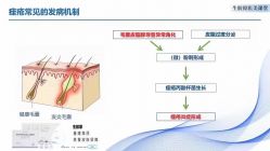 -MLP美丽派·问题肌疗愈中心