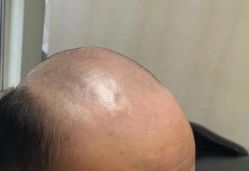 -发饰美男士增发补发假发定制店