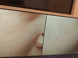 -苑苑vbeauty科技美容SPA
