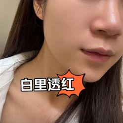 -AGE LOCK 锁龄美肌