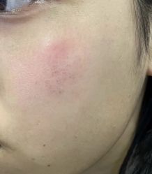 -美瑞莎创美医疗美容
