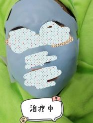 -苗医生草本科技祛痘