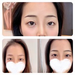 -MIVI半永久纹眉绣眉