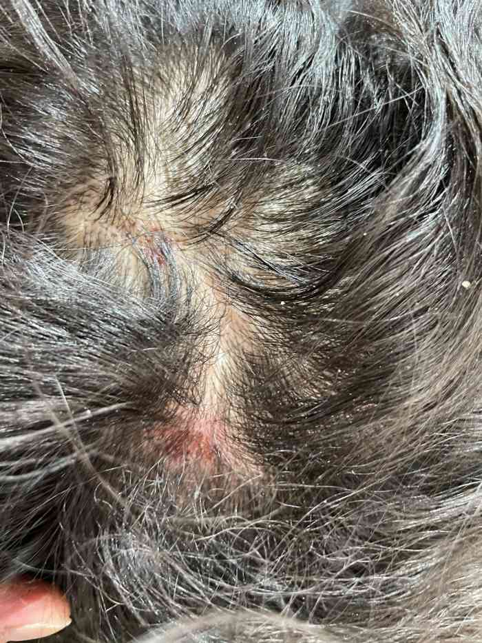 打分 我只能说服务还可以 带朋友去结果头皮给烫伤了两处 充钱办卡