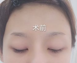 点击看大图 -Yue Show馨选·半永久纹眉纹眼线