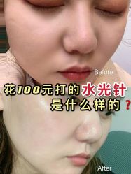 -西安壹加壹医疗美容医院