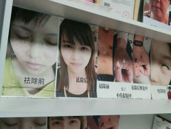 -痣清宫祛斑祛痣连锁店