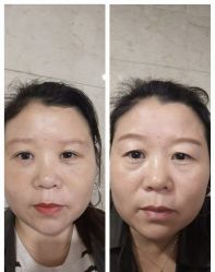 -杭州米兰柏羽医疗美容医院