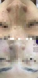 -蕾特恩专业祛痘·皮肤管理