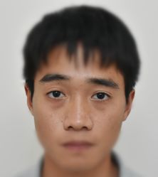 -天津健丽·去眼袋医疗美容机构