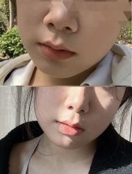 -Yestar艺星医疗美容医院