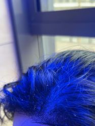 -碧莲盛·不剃发植发