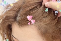 -大麦微针植发全国连锁