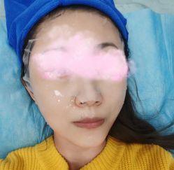 体验前-紫洁俪方（北京）医疗美容