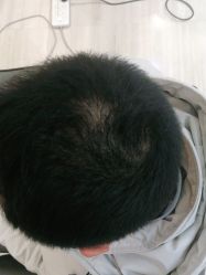 -雍禾植发全国连锁