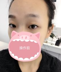 点击看大图 -MIVI·纹眉半永久野生眉