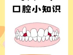 -上海仁爱医院口腔科 · 种植