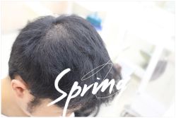 -大麦微针植发全国连锁