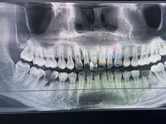 -土豆口腔(凤凰北总店)