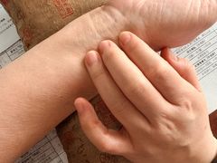 -悦和堂中医门诊部·疼痛调理·针灸推拿·艾灸拔罐