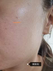 -正璞医疗美容·皮肤修复·微整注射