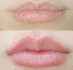 体验前-洁铭新加坡医美