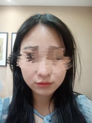 体验前-厦门美莱整形美容医院