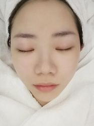 点击看大图 -悟空祛痘·专业祛痘机构