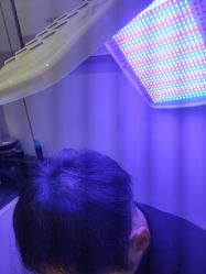 体验后-熙朵美学植发·连锁品牌