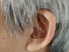 -宁耳听力助听器奥迪康峰力西门子斯达克(静安闸北店)
