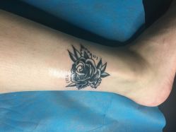 -明星刺青·洗纹身