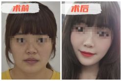 -素美医疗美容·西南眼鼻整形·修复基地