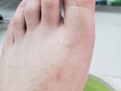 -新甲连锁灰指甲·甲沟炎·鸡眼(黑龙江路店)