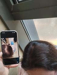 -碧莲盛·不剃发植发