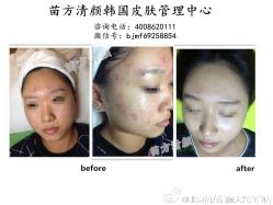 点击看大图 -苗方清颜痘肌研究所