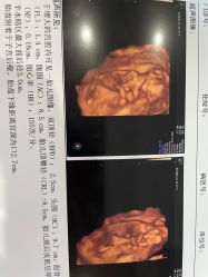 -武汉都市妇产医院