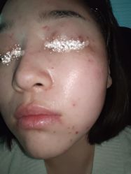 -紫洁俪方（北京）医疗美容