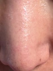 体验后-南京医科大学友谊整形外科医院