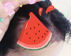 -大麦微针植发全国连锁