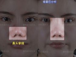 -北京米扬丽格医疗美容·联合丽格鼻整形中心