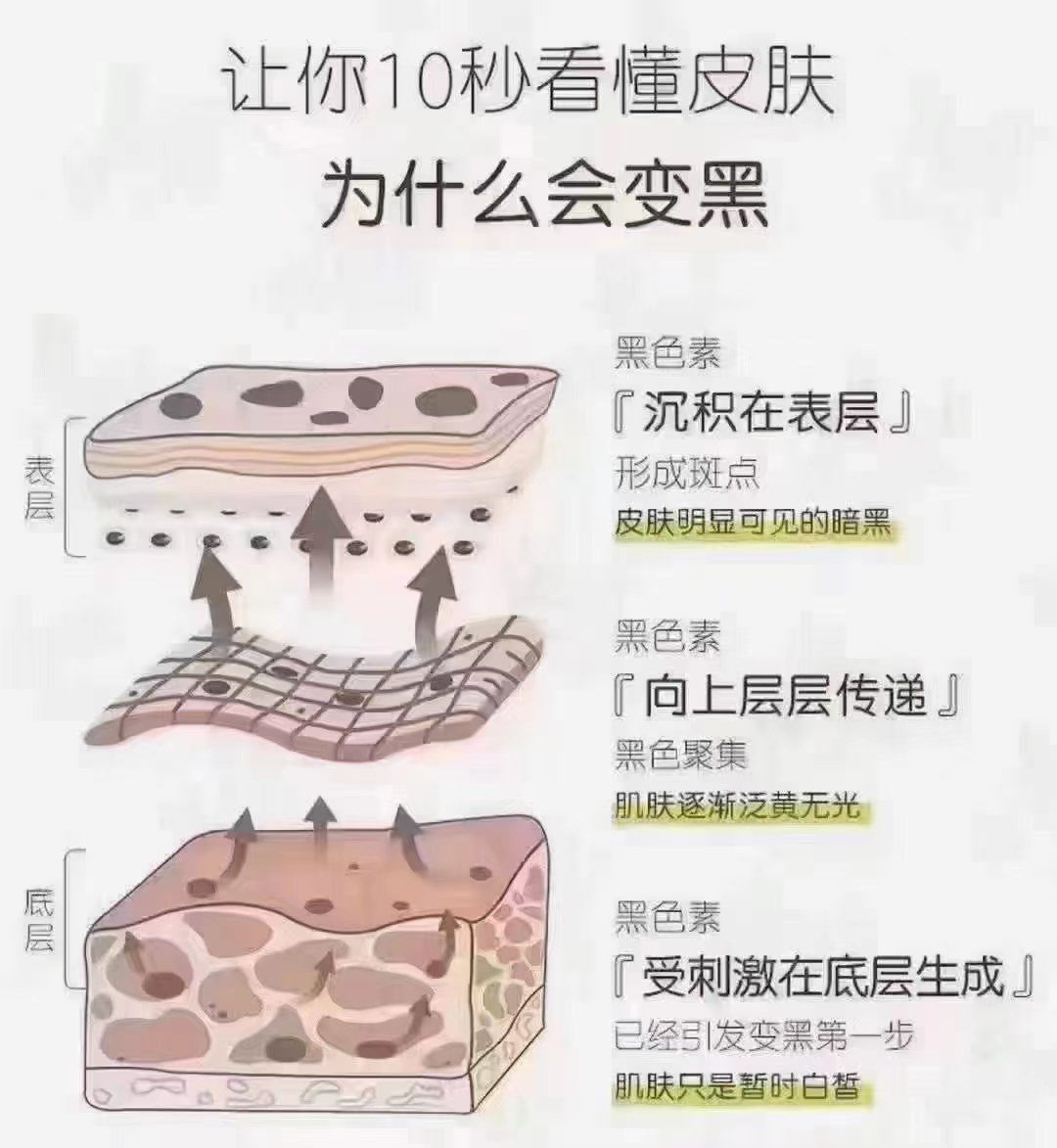 为什么皮肤会变黑