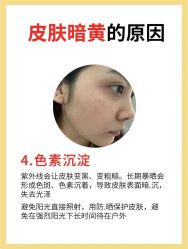 -克丽缇娜